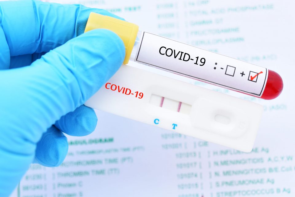 Ковид состојба: Нови 17 починати, 87 заразени