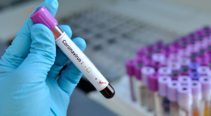Нови 342 случаи на коронавирусот, седум починати