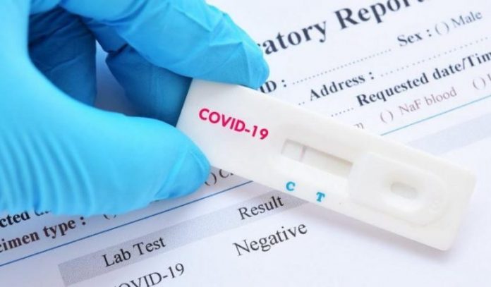 Над 800 луѓе во Австралија поради грешка на лабораторијата добиле погрешни резултати од тестот за коронавирус