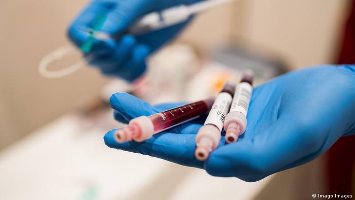 50-годишна скопјанка третпат добила позитивен тест на коронавирус