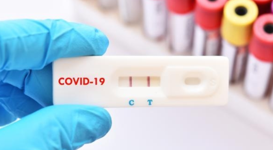 Регистрирани 108 новозаболени од Ковид-19, не се пријавени починати лица