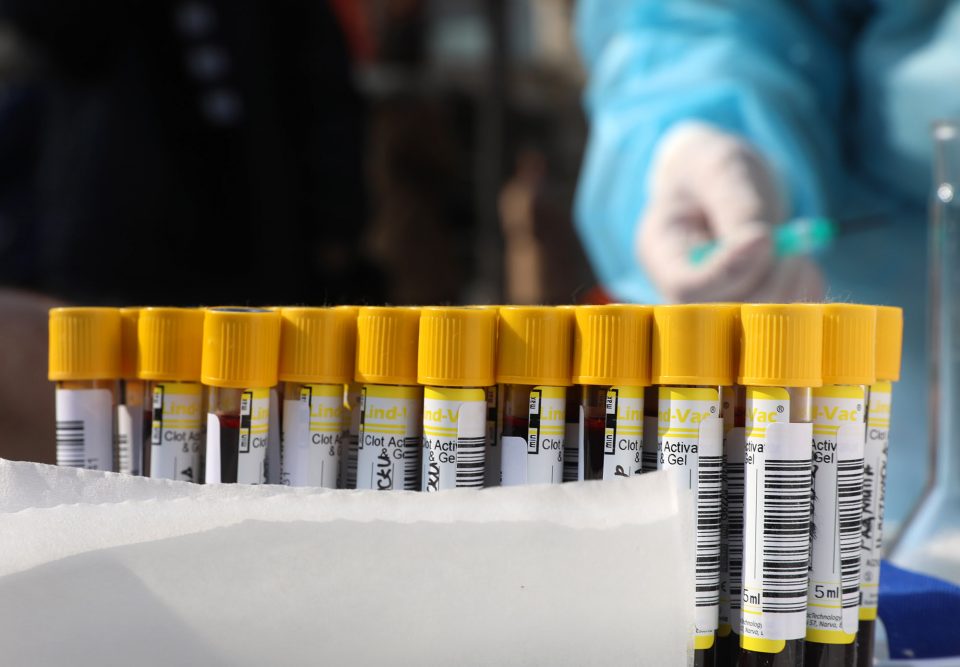 Активни 1.351 случај, се очекува поинтензивна кампања за вакцинација против Ковид-19