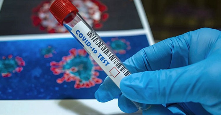 Нови 1.233 заразени и седум починати од КОВИД-19
