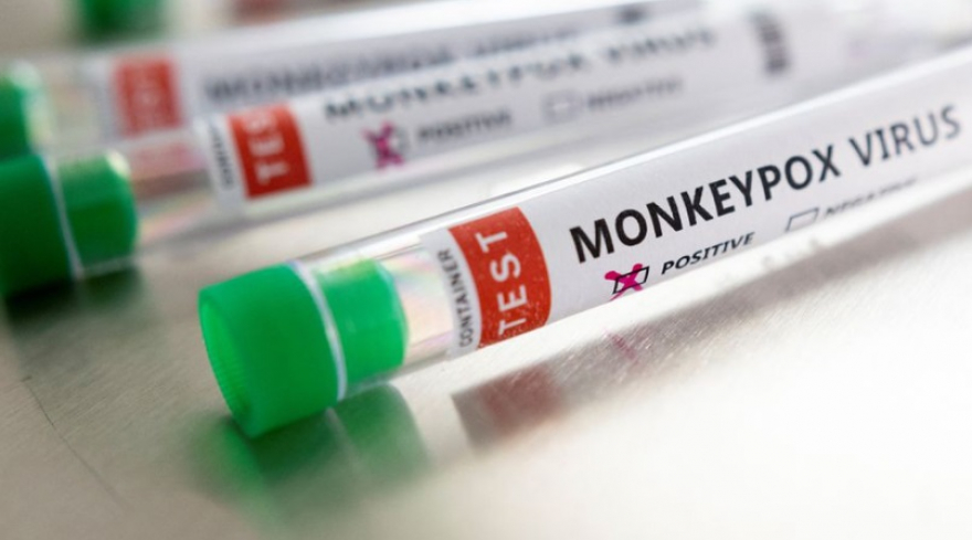 Во Грција потврдени вкупно 11 случаи на мајмунски сипаници