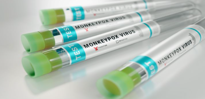 Мехмедовиќ: Кичевчанецот е тестиран за мајмунски сипаници, во моментов е во изолација