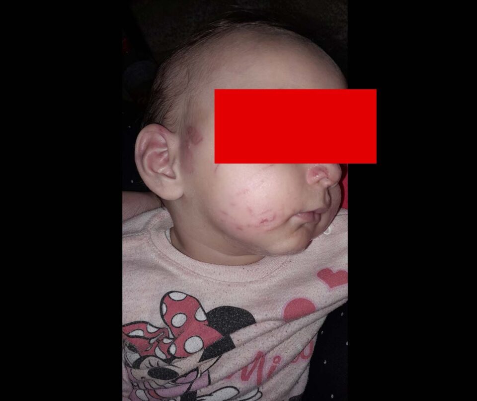 Петкова: Десетмесечно бебе со тешки повреди во гевгелиска градинка, директорката се обидела да го сокрие случајот