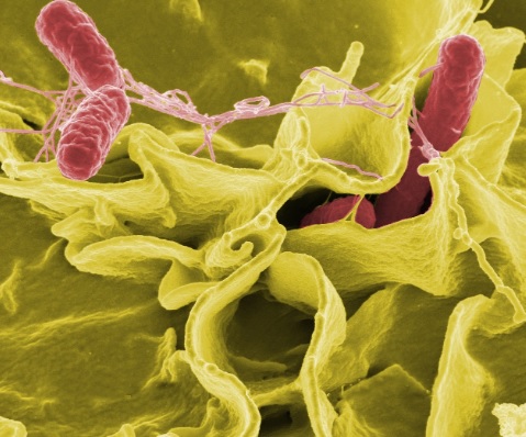 Уште шест деца заразени од салмонела во Берово