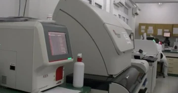 КБ Штип воведува нов пренатален скрининг: Тестот е бесплатен за сите осигурени трудници