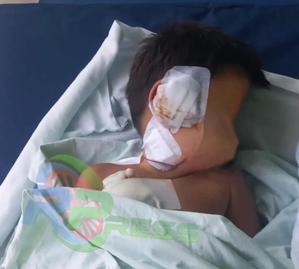 УЖАС ВО ШУТО ОРИЗАРИ: Едно и полгодишно дете јадело виршли, па му се нафрлило улично куче и го искасало по телото и лицето